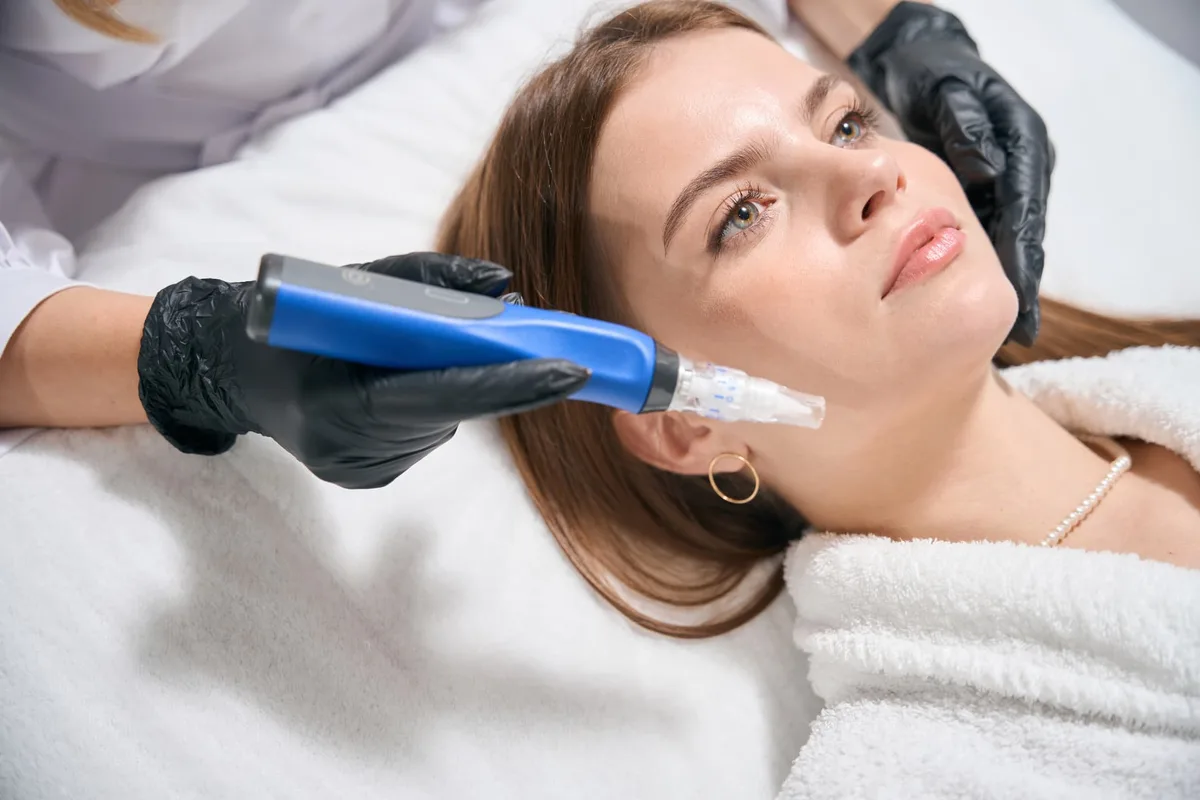 SkinPen® Precision Microneedling bei skin.concept